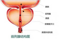 怎么辨别前列腺痛